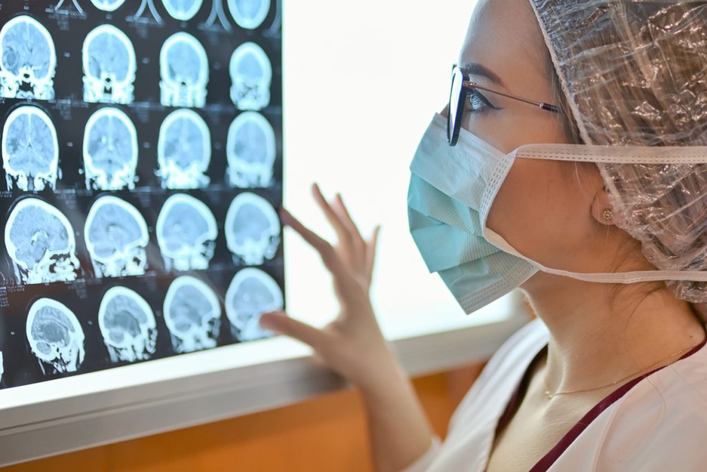 Junge Ärztin untersucht MRT-Bild